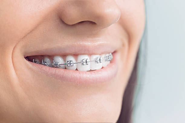 Dental Inlays and Onlays in Richland, WA
